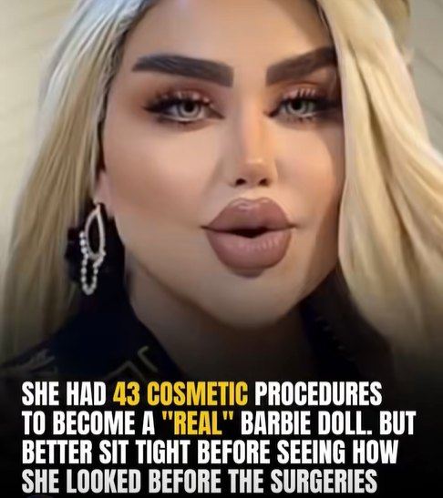 She had 43 cosmetic procedures to become a “REAL” Barbie Doll. But better sit tight before seeing how she looked before the surgeries