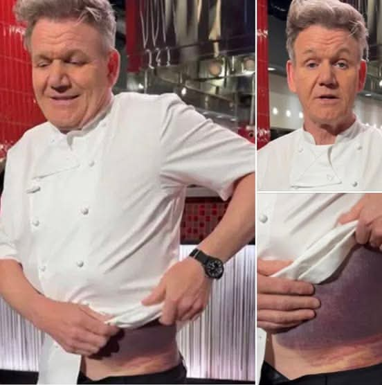 Gordon Ramsay shares message after potentially fatal accident