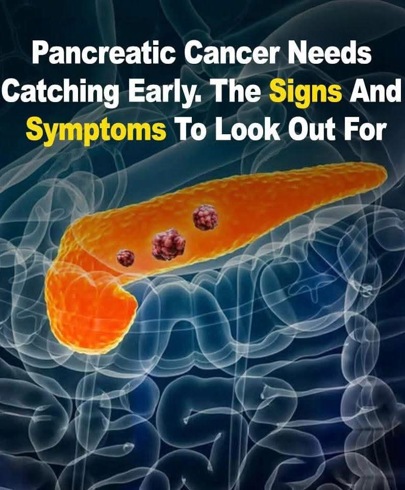 Pancreatic canc3r symptoms you should know, and how the disease develops