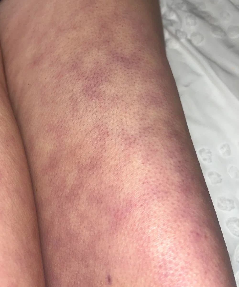 ‼️These are the consequences of sleeping with the… See more