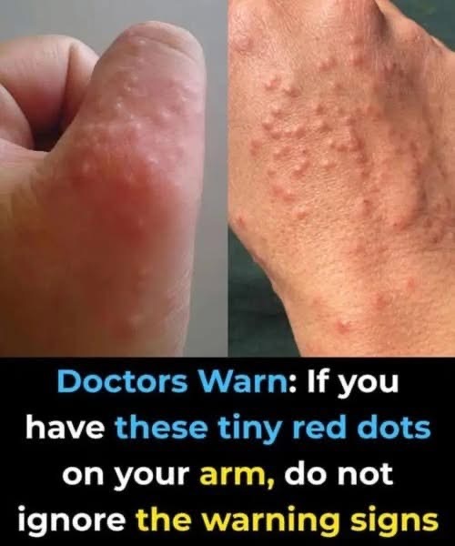 Doctors warn: if you have these tiny red dots on your arm or hand, do not ignore the warning signs