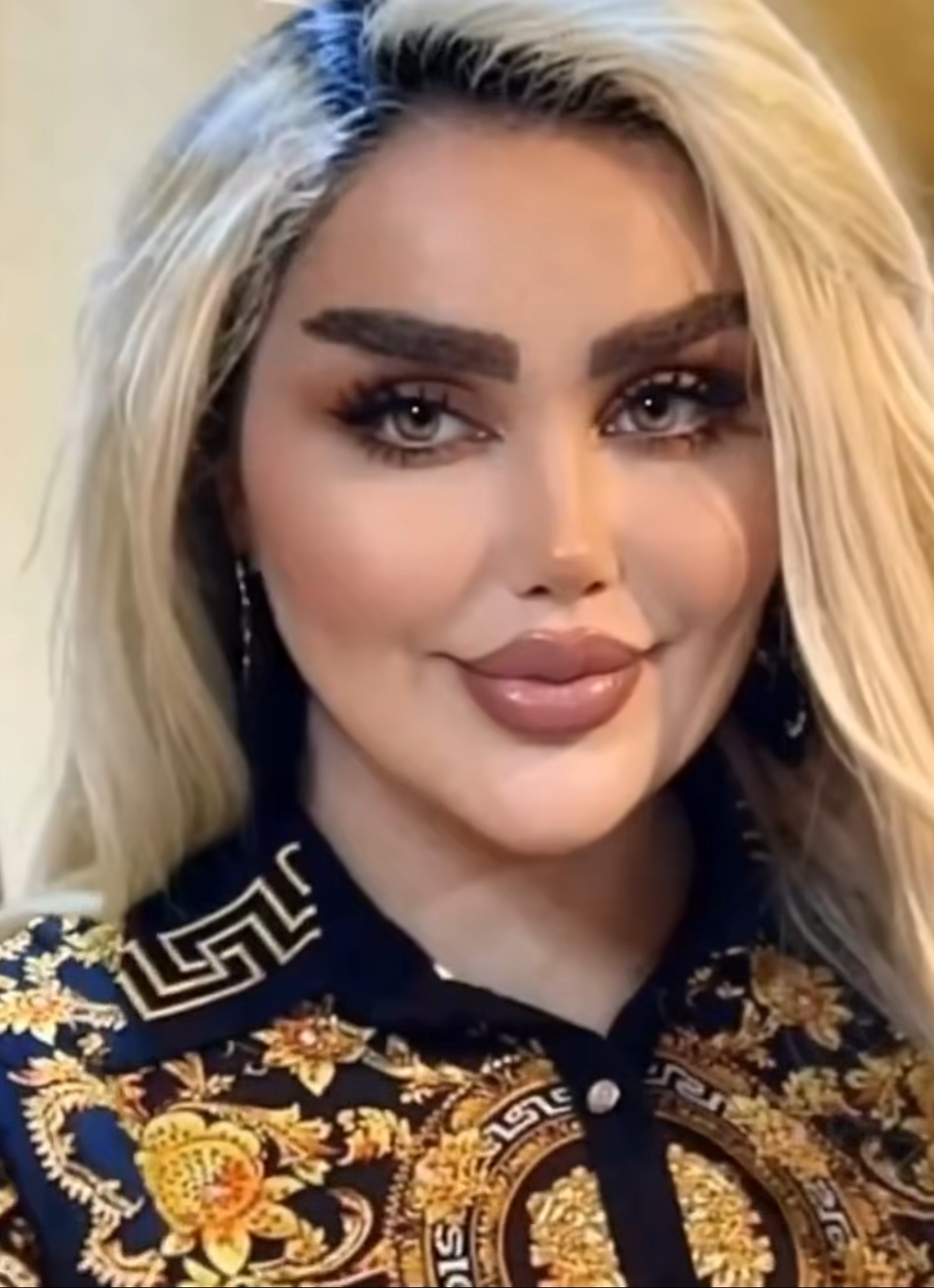 She had 43 cosmetic procedures to become a “REAL” Barbie Doll. But just wait until you see how she looked before the surgeries  photo in comments