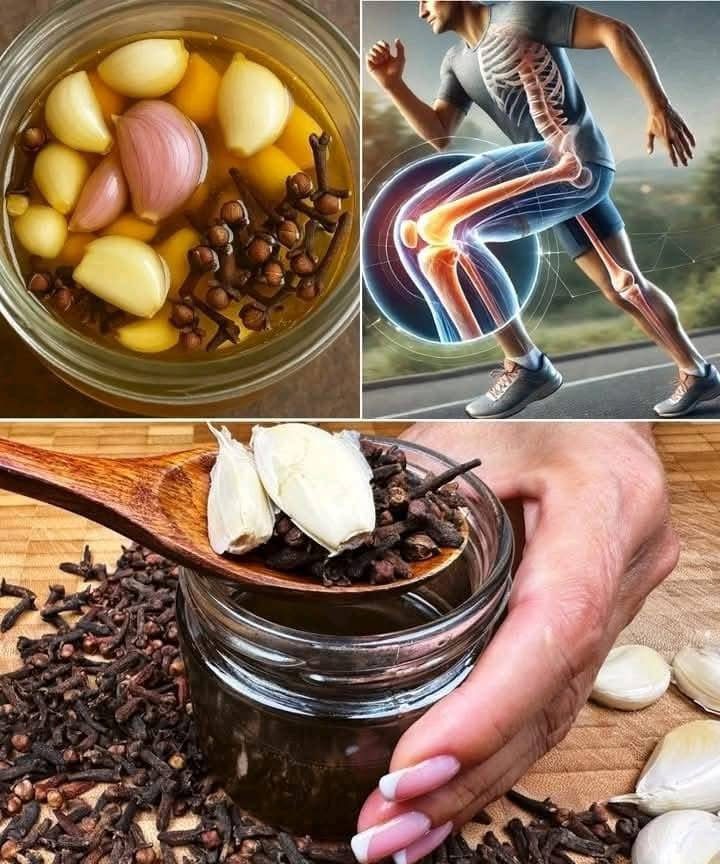 Leg pain, rheumatism, varicose veins, arthrltls My mother couldn’t walk because of pain… Full recipe in the COMMENT SECTION⤵️⤵️
