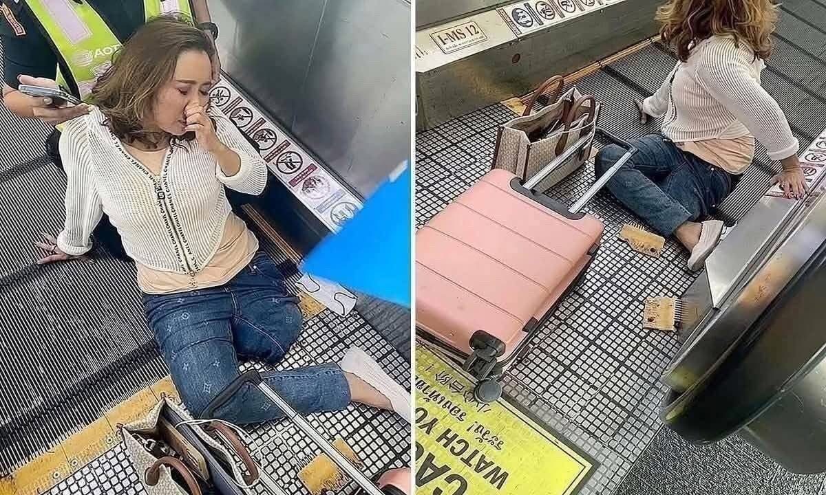 57-year-old woman, LOSES her leg after getting STUCK on an escalator in the… See more
