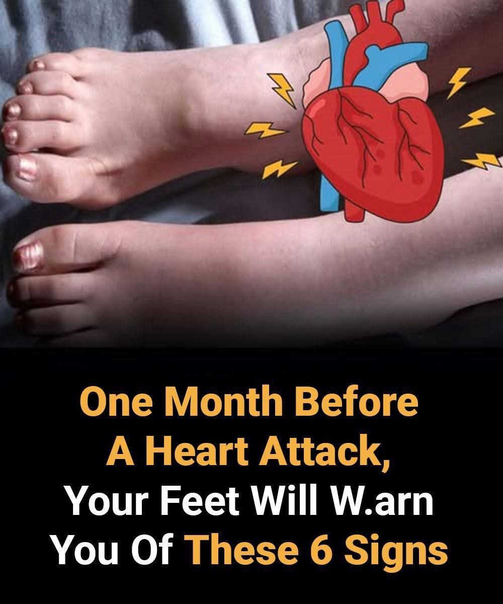 ‼️One month before a heart att’ack, your feet will warn you of these 6 signs, especially to the 3th