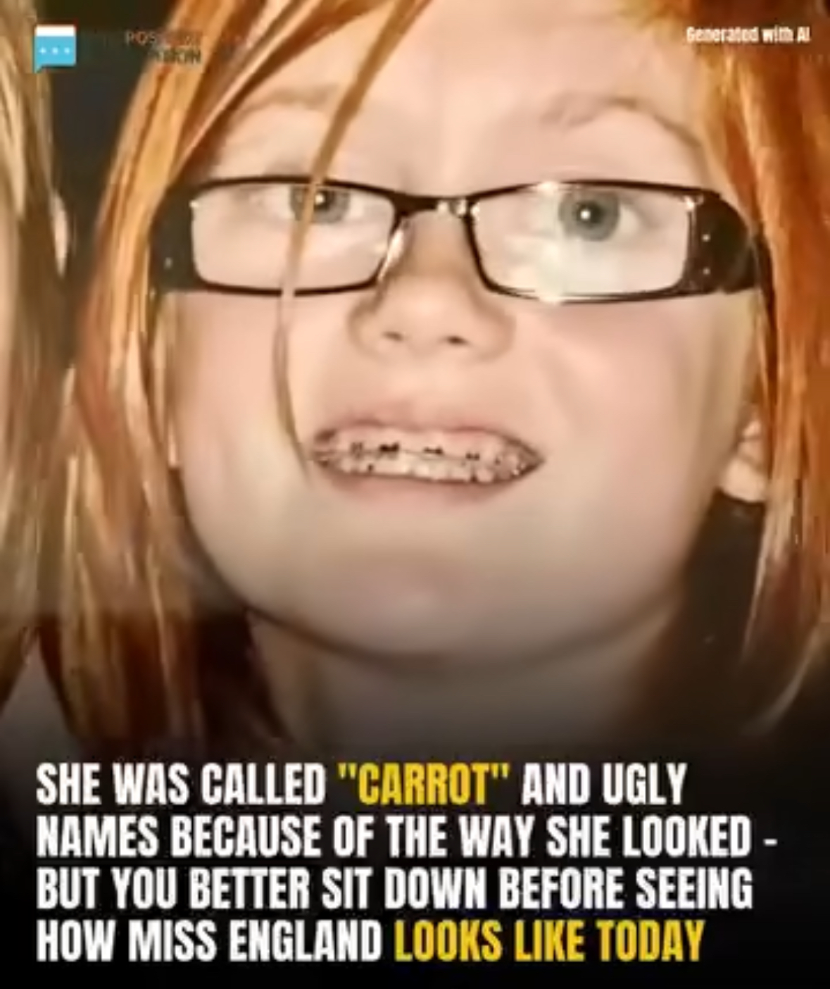 She was called “carrot” and ugly names because of the way she looked – but you better sit down before seeing how Miss England looks like today  Photos in comm