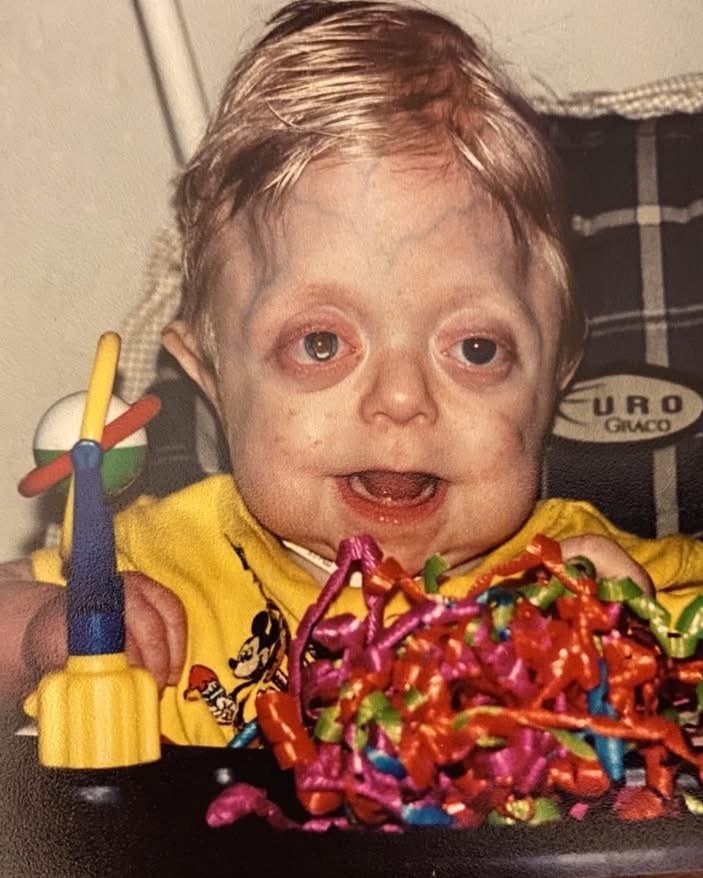 When little Braden was born, his mom prayed that the Lord would bring him home to ease his pain. But when looking at this precious boy 22 years later, it\’s difficult not to shed a tear… ❤️😱 See in comments 👇