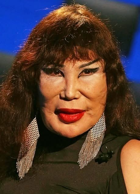 😯She was a famous actress who appeared in around 100 films,👀 but one trag¡c mistake completely ruined her appearance… Many people are sh0cked to see how she looked like before, and you better sit down 😨 Check the comments to see ⬇