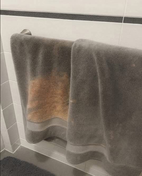 😲Every towel I own ends up with weird orange stains that never wash out. 👀This one’s barely a month old — any idea why? And why always orange? All my towels are ruined!👇