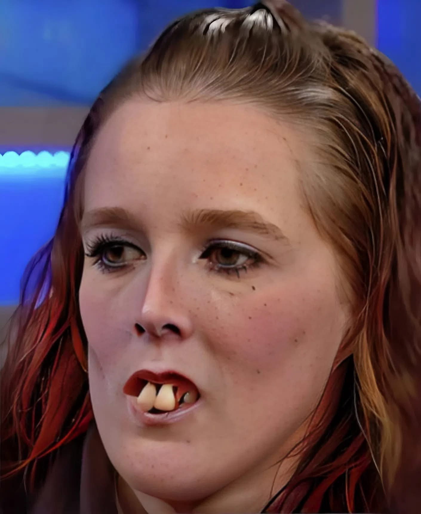 😯A few years ago, this woman became popular on social media because of her appearance . 🤔Due to the condition of her teeth, many criticized and mocked her . But it was precisely because of this that famous dentists noticed her and offered her a free procedure . Thanks to this, her smile and overall appearance changed dramatically, and now she looks much more beautiful . Are you curious to see how this girl looks today? If so, her photo after the changes is shown in the first comment😯👇