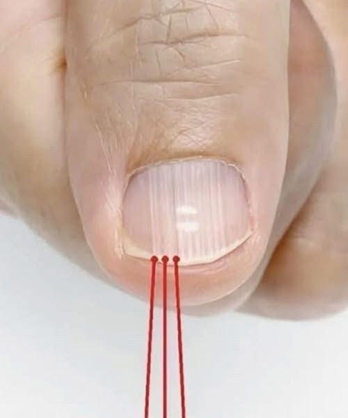 If you have these lines on your nails after 40, it is a clear sign that.. Check 1st comment 👇