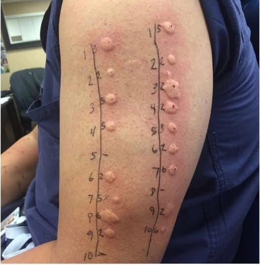 These are the consequences of sleeping with the… See more.