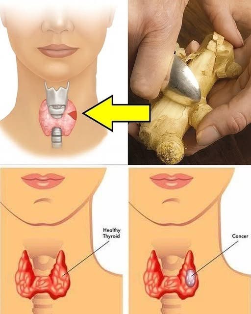 19 Foods to Avoid with Thyr0id Problems, check the first comment 👇 👇