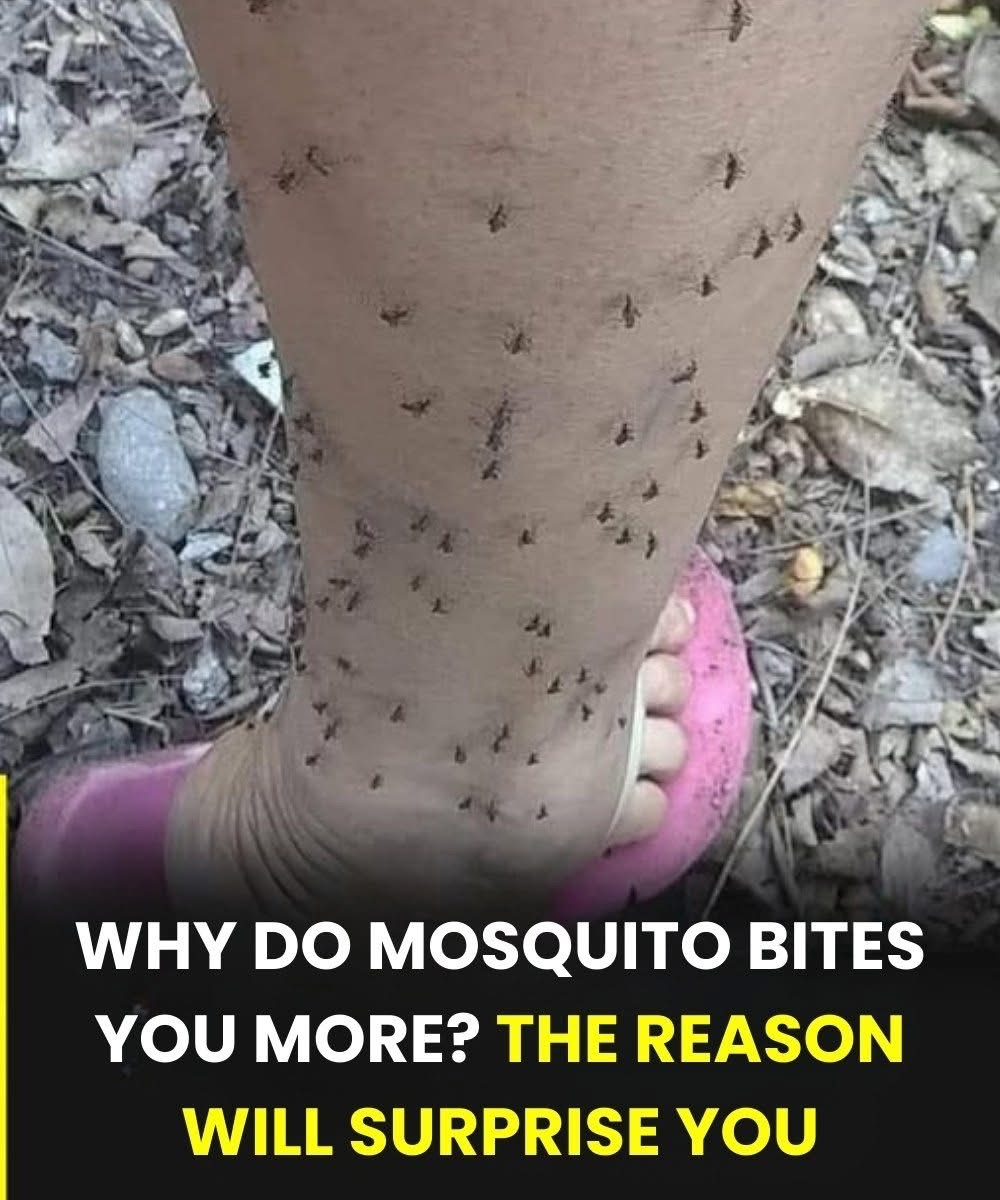 Why do mosquitoes only bi:te you? The reason will surprise you… Read more 👇