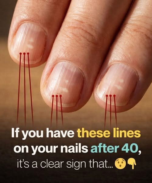 If you have these vertical lines on your nails after 40, it’s a clear sign of… see more 👀👇