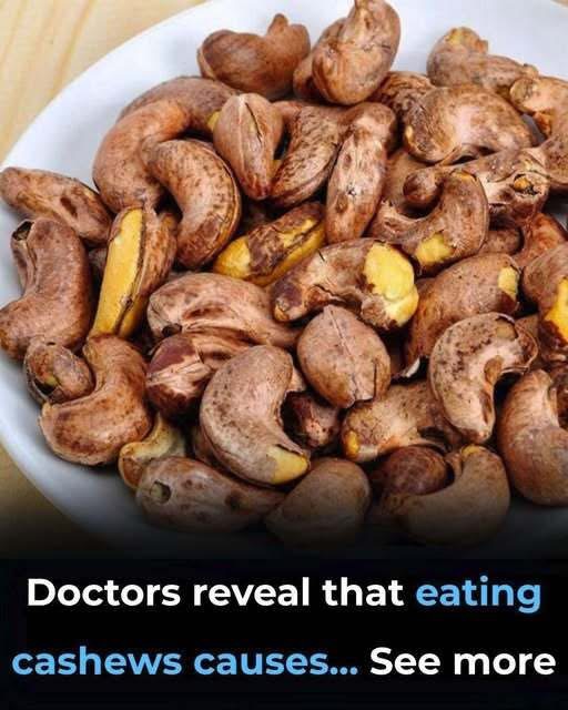 Doctors reveal that eating cashews causes…More details in comments below 👇