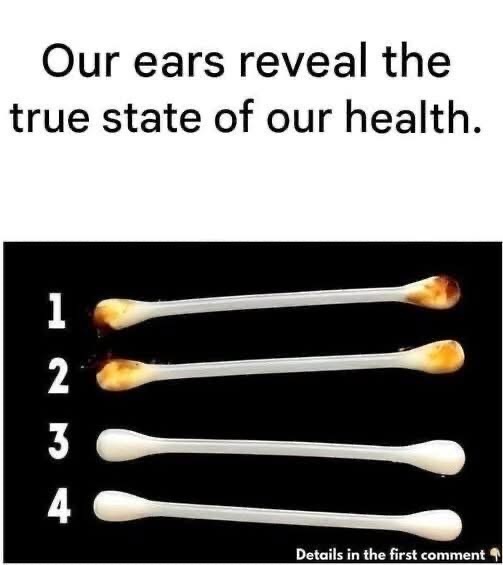 😯Our ears reveal the true state of our health.⤵️