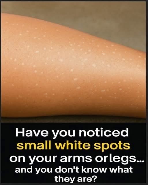 😯Have you noticed small white spots on your arms or legs… 👀and you don’t know what they are? Here’s what a specialist says check 1st comment.👇..