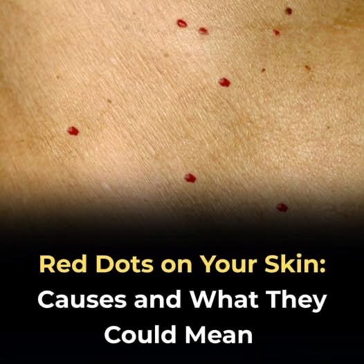 If you spot these red dots on your skin, you had better know what they mean 😮