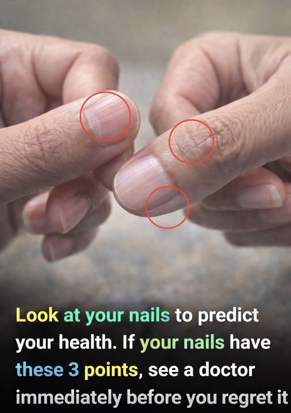 How to spot health issues by looking at your nails 😲