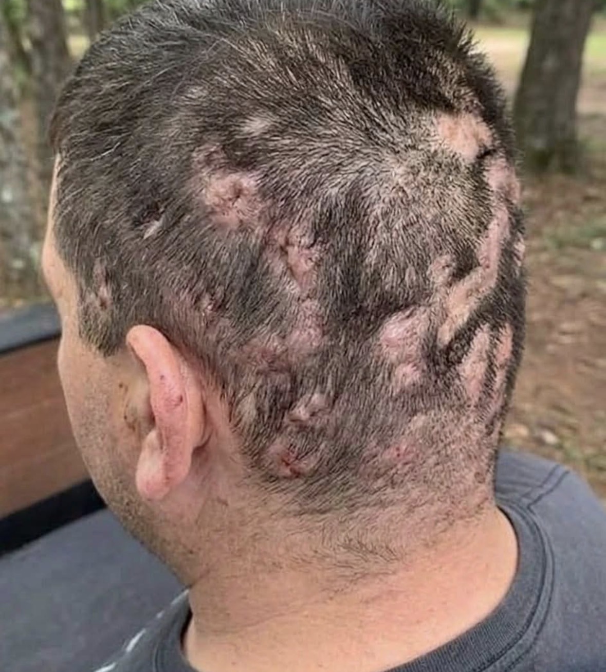 These are the first symptoms of sleeping with…😥 👇