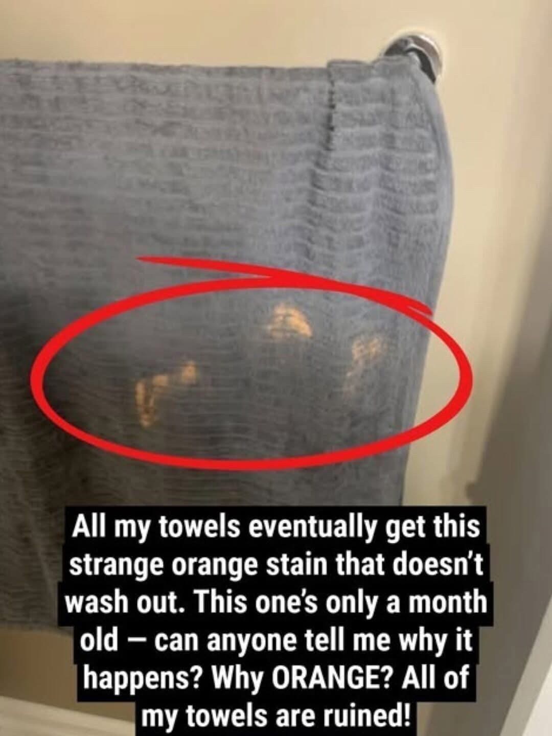 😲Every towel I own ends up with weird orange stains that never wash out. 👀This one’s barely a month old — any idea why? And why always orange? All my towels are ruined!👇