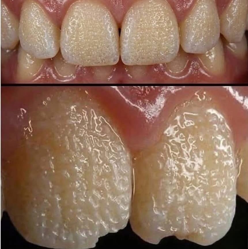 🚨 Be careful!! This is what your teeth will become when you eat…see below