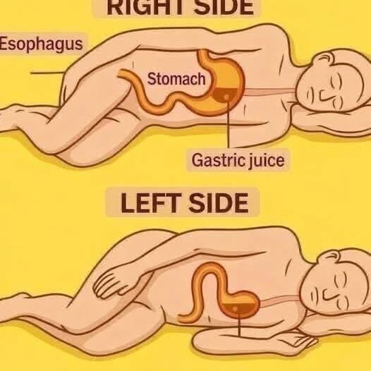 🚨CAUTION if you sleep on your right side…See More🚨CAUTION if you sleep on your right side…See below