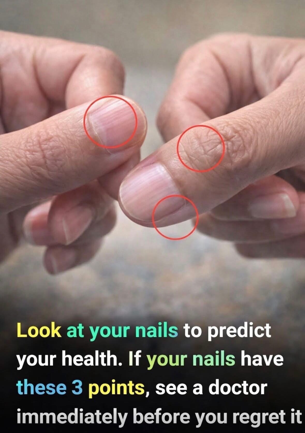 How to spot health issues by looking at your nails 😲