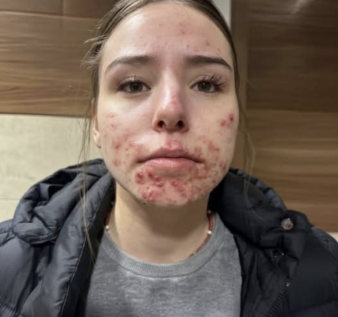 These are the consequences of sleeping with a…See below