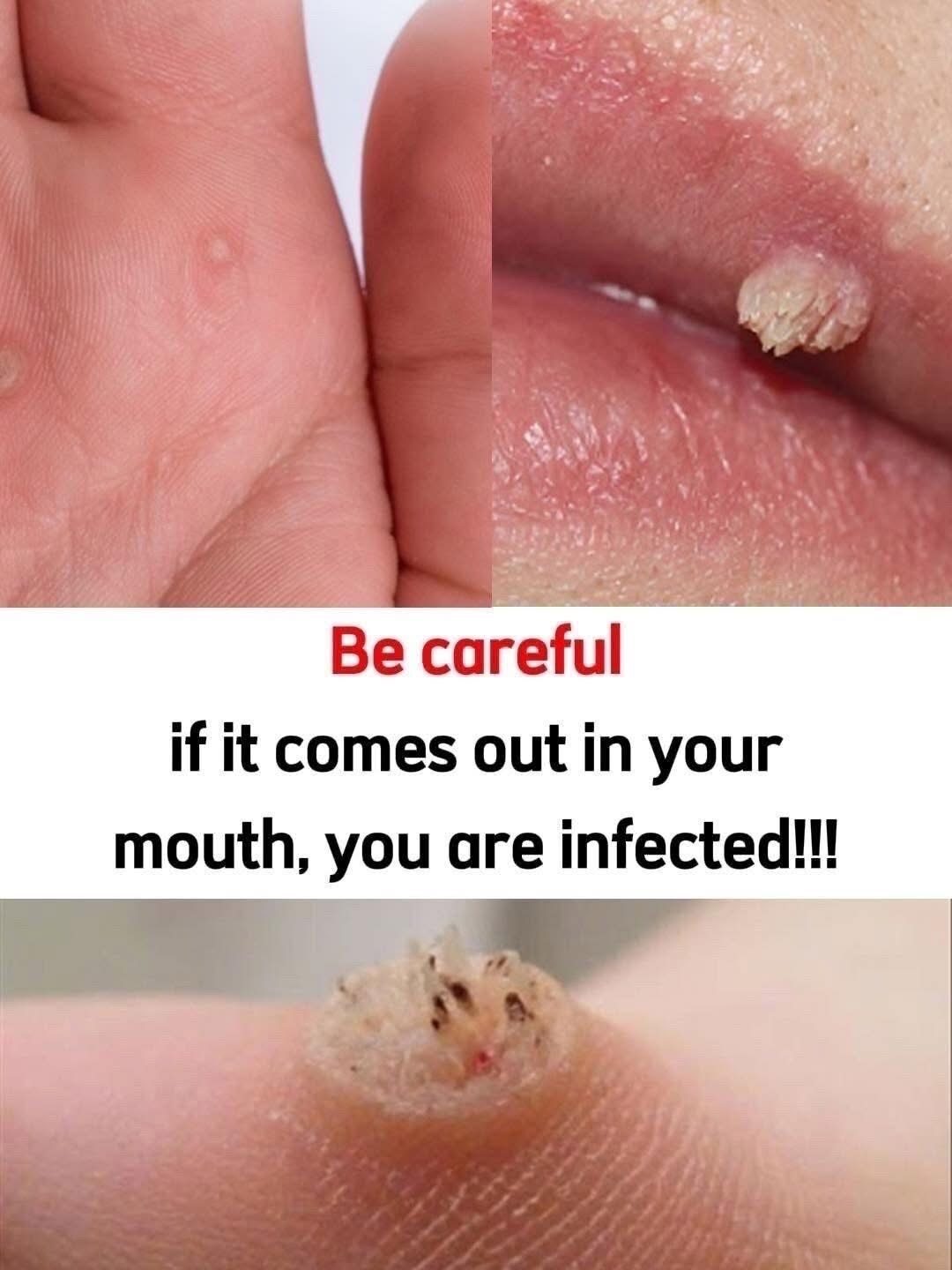 These are the first signs of an enf…See below