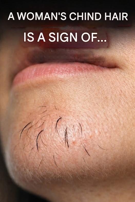 A woman’s chin hair is a sign of…See below