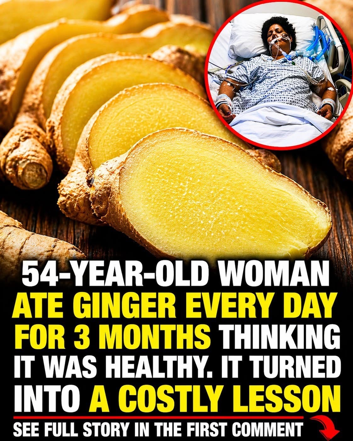 54-Year-Old Woman Thought Ginger Was Healthy Ate It Daily for 3 Months and Paid a Painful Price