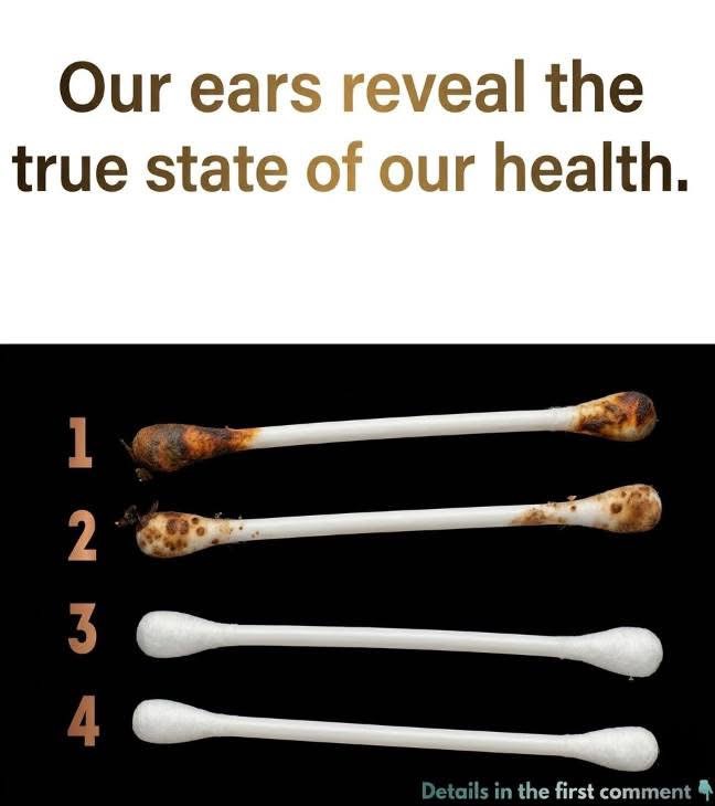 😯Our ears reveal the true state of our health.⤵️