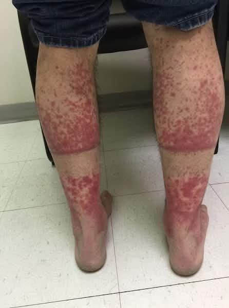 These are the consequences of sleeping with the…See more…… what ®