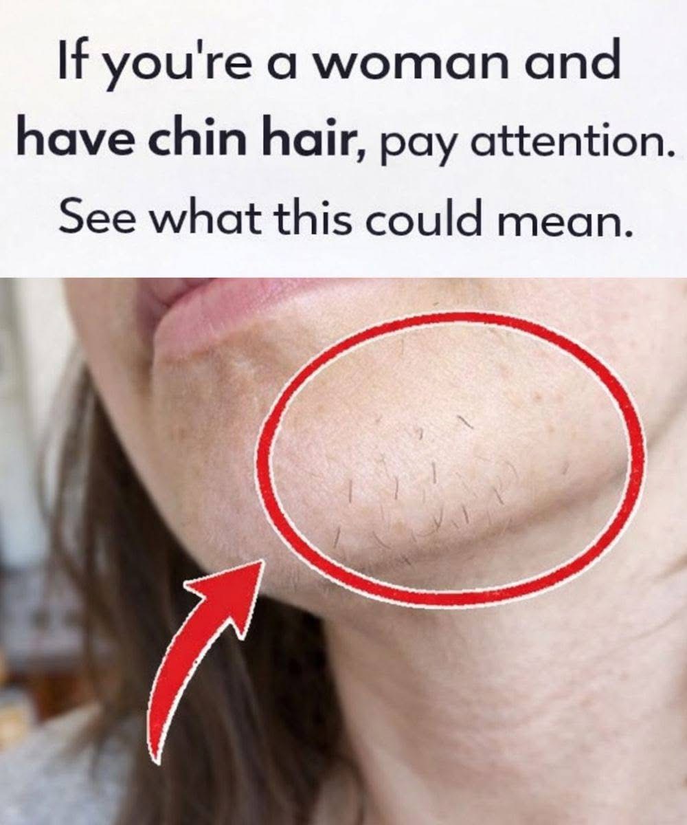 If you’re a woman and you have hair on your chin, pay attention and see what that means. See below…👇👇