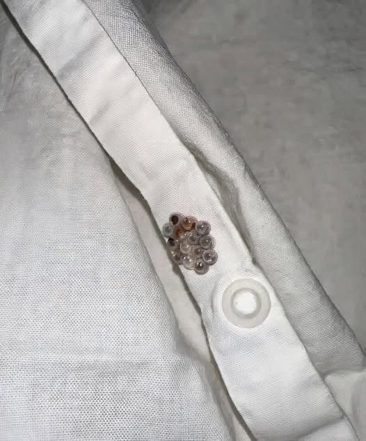 I found these tiny balls in my bed and nearly had a heart att.ack: here’s what they were. Check 1st comment ⏬..