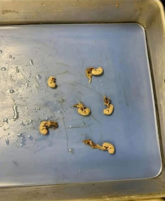 They look like little seeds but they are… See below