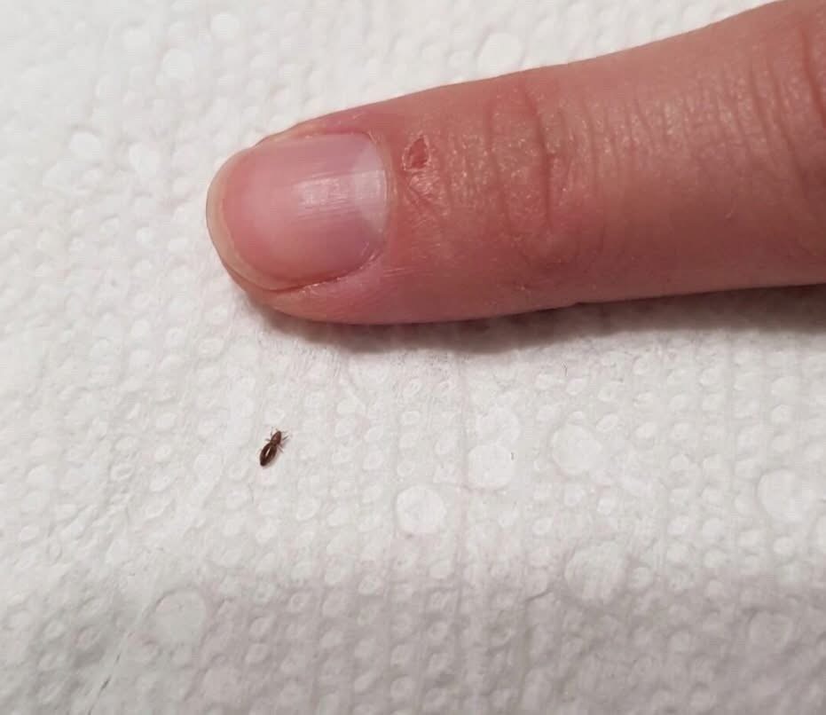 ”Wife found this in our toddler’s hair. Anything we should worry about? He goes to daycare 3 times a week.😳