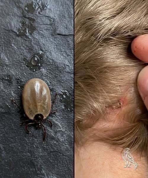 Does anyone know what kind of insect this is? I just found it on my son’s head… Check 1st comment 👇👇