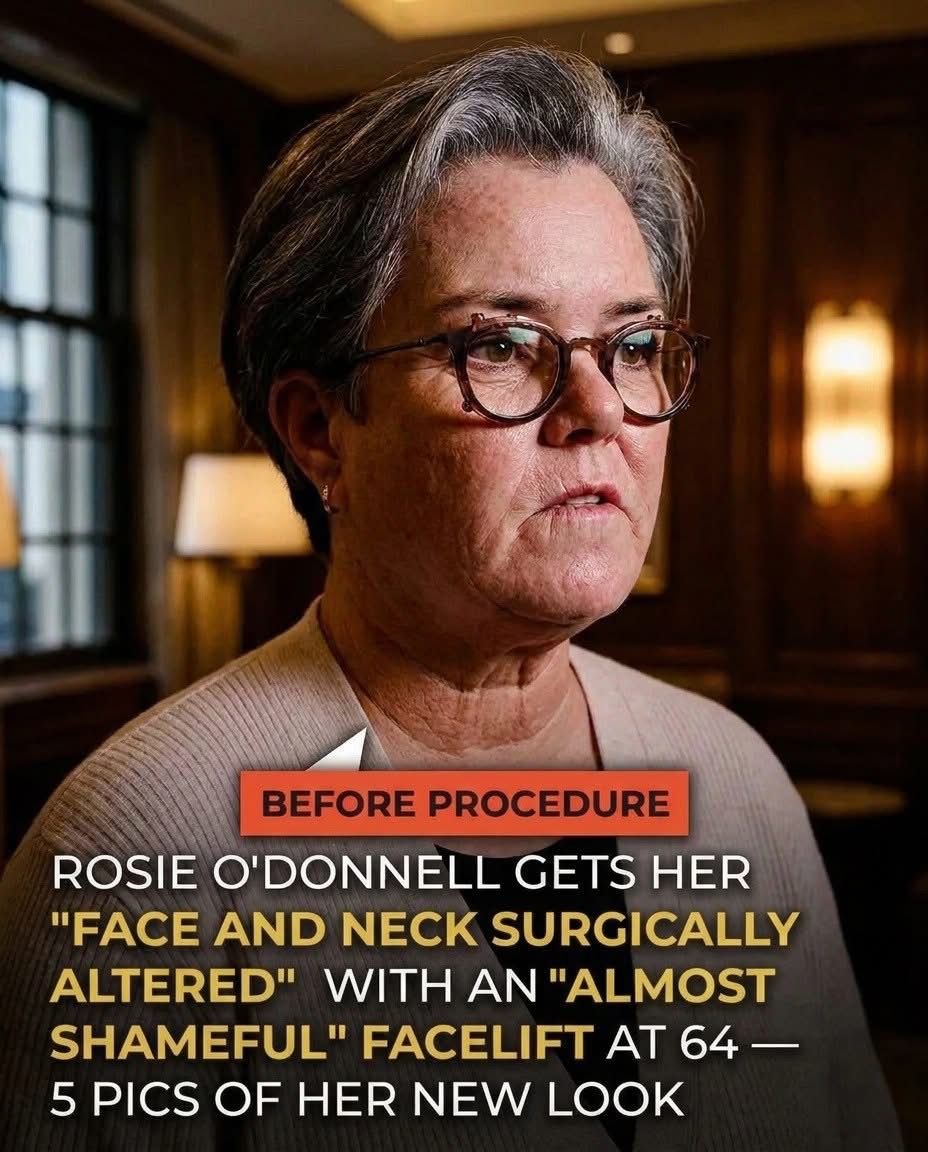 “I thought it was a BETRAYAL. Of feminism. Of aging,” Rosie O’Donnell said in her update. 😲 5 PHOTOS of her FACELIFT REVEAL are in the comments. ⬇️ Is there an obvious difference between her BEFORE and AFTER look? 🤔