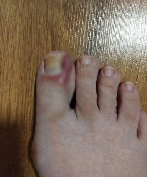 🔴 Signs on your FEET that indicate you are cr…See below👇