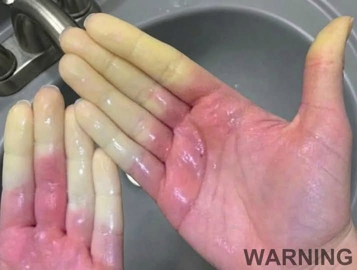 These are the consequences of sleeping with a… See below
