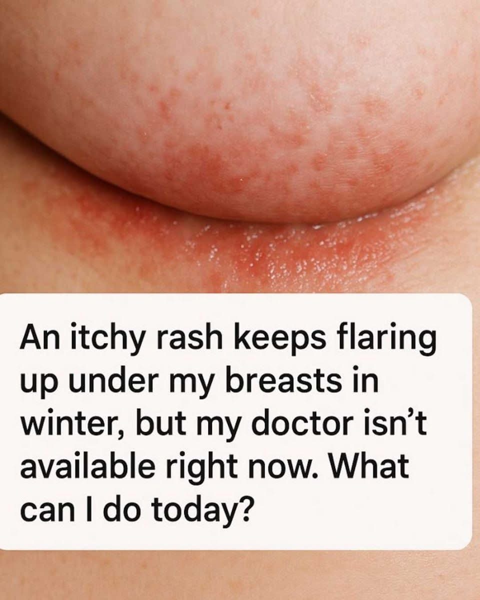 I’m honestly struggling — an irritating rash under my breasts keeps coming back this winter, and my doctor isn’t available. What can I safely do in the meantime?