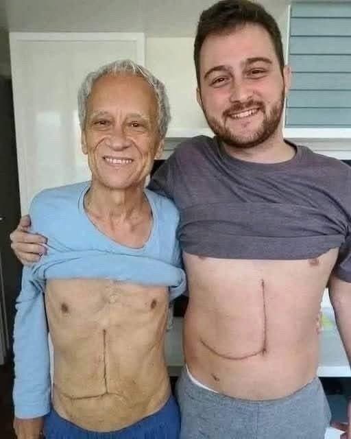 Son who donated part of his liver to his father unfortunately ends up fa… See below