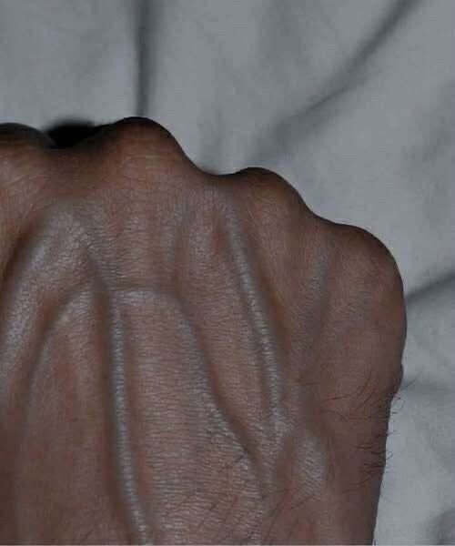 If your veins are visible in your hand, it is a signal of ca… 😳See below