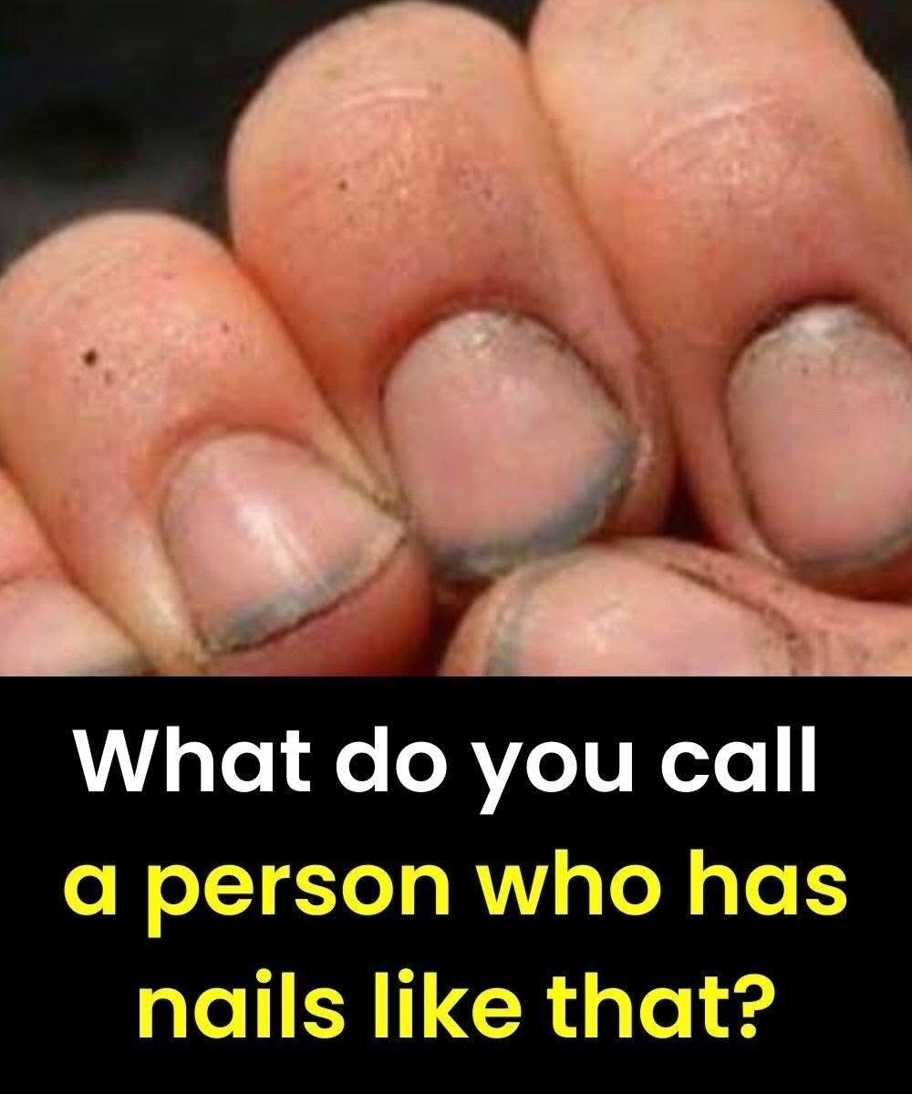 What do you call a person with nails like that?…………..see below 👇