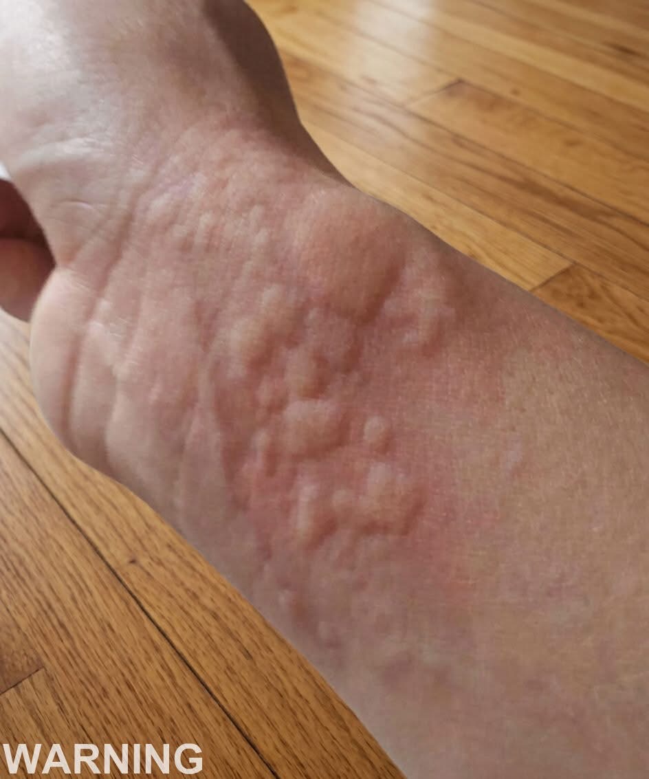 These are the consequences of sleeping with a… See below👇