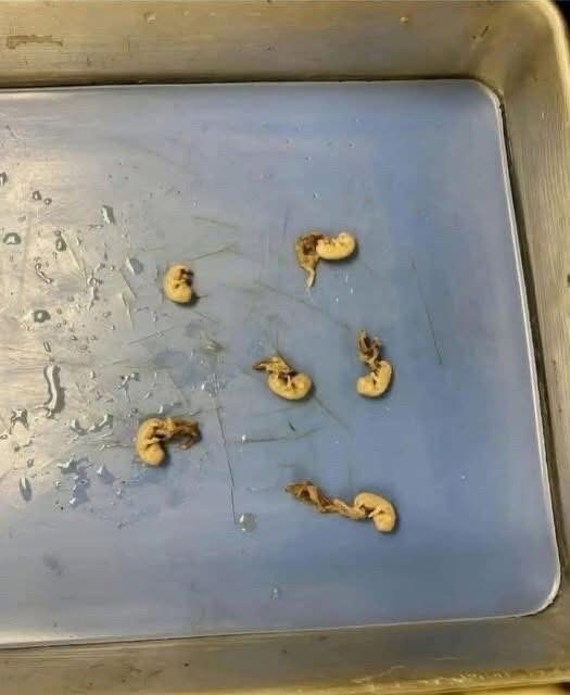 They look like little seeds but they are.. See below👇👇..