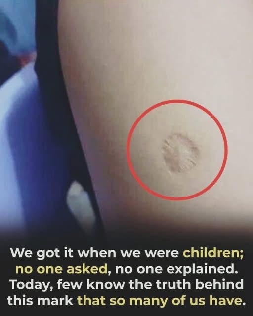 The small round scar on your arm: possible explanations (Check first in all comments👇)